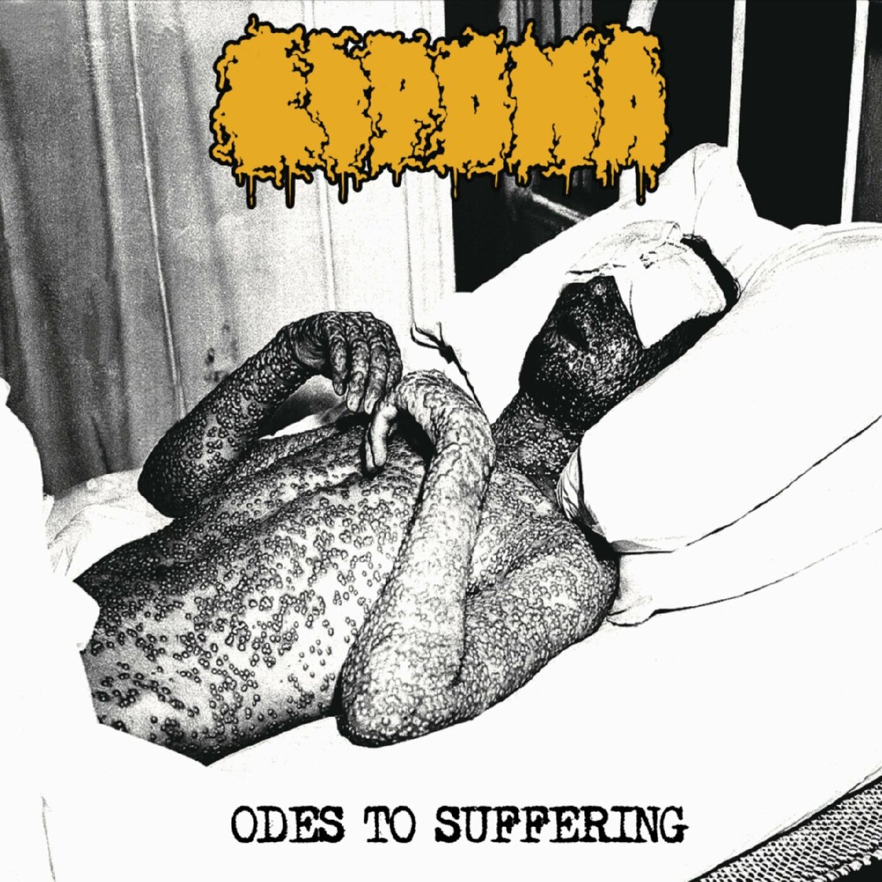 Lipoma - Odes To Suffering (2023) Goregrind (D4)
