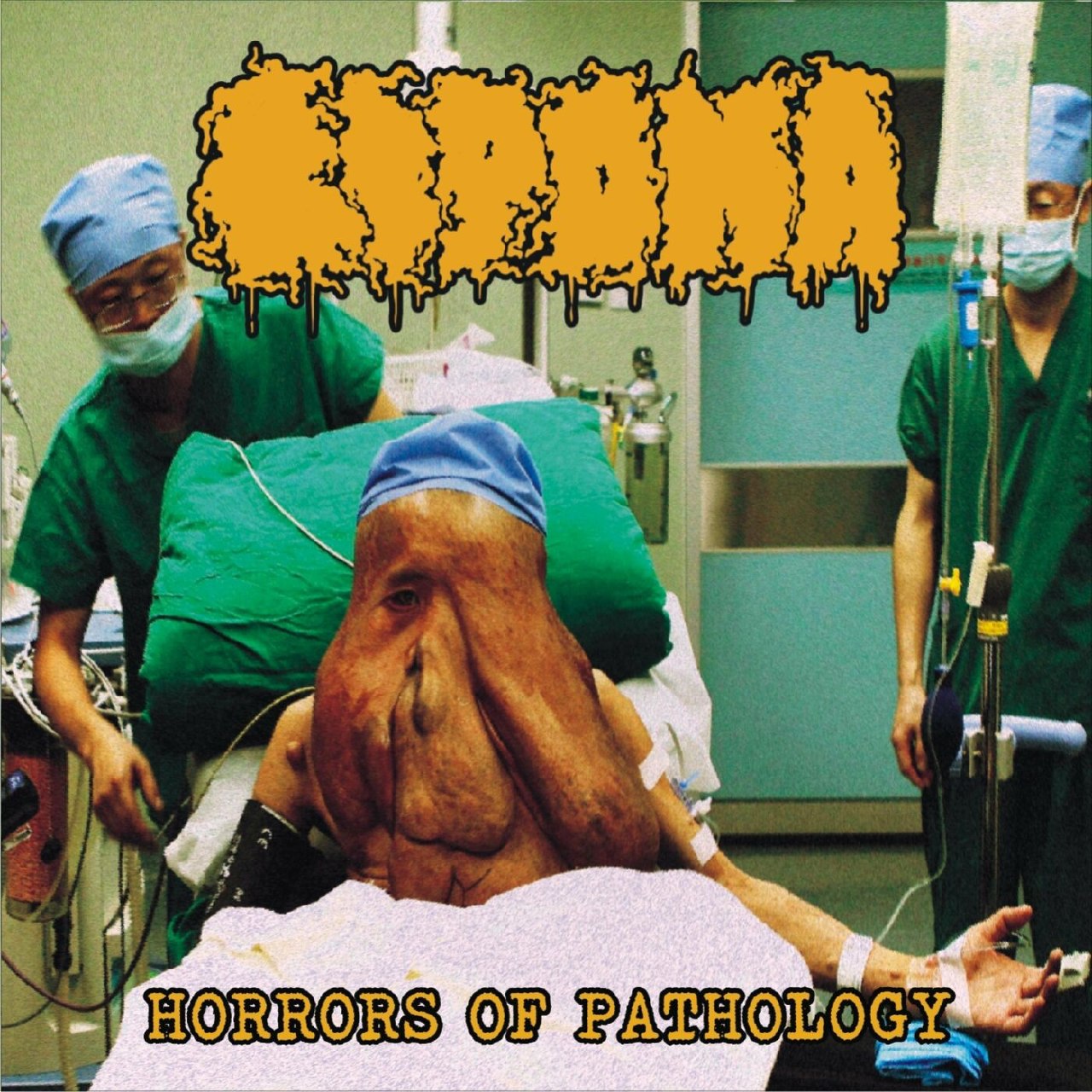 Lipoma - Horrors Of Pathology (2022) Goregrind (D10)